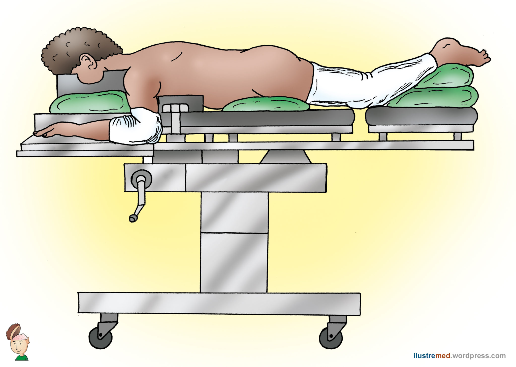 Cirurgia minimamente invasiva da coluna Cirurgia da Coluna Neurocirurgião São Paulo SP